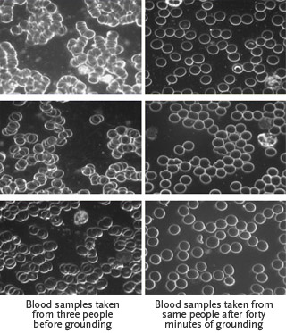 Blood Viscosity Samples